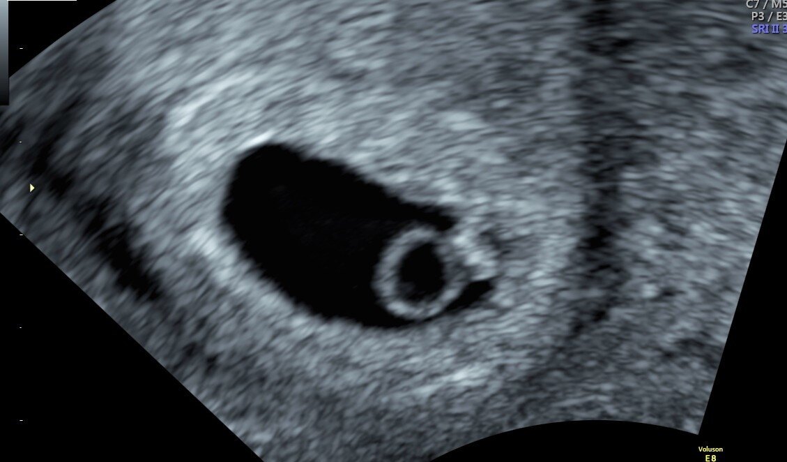 Blog Details